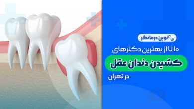10 تا از بهترین دکترهای کشیدن دندان عقل در تهران