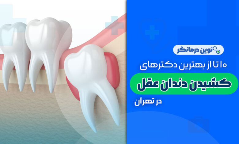 10 تا از بهترین دکترهای کشیدن دندان عقل در تهران