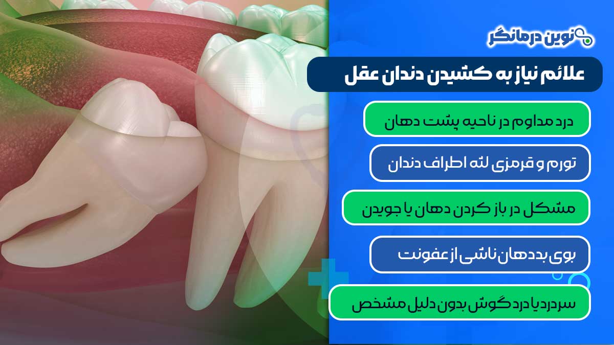 علائم نیاز به کشیدن دندان عقل