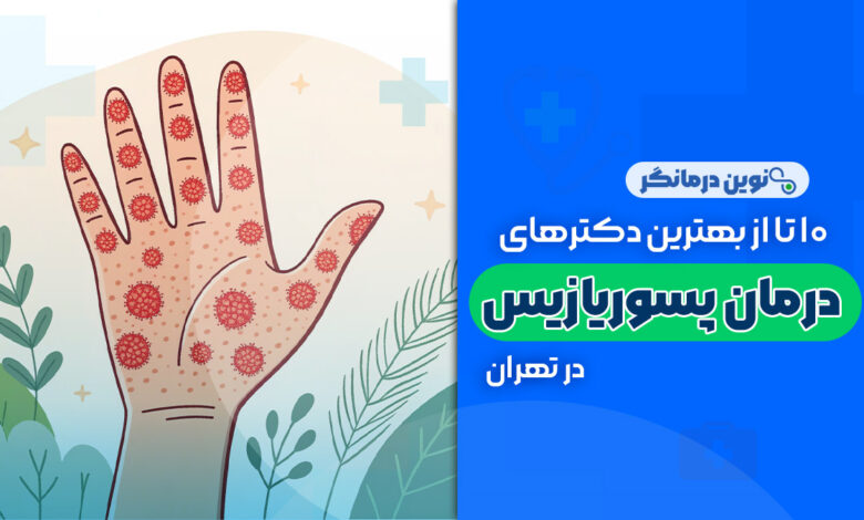 10 تا از بهترین دکترهای درمان پسوریازیس در تهران