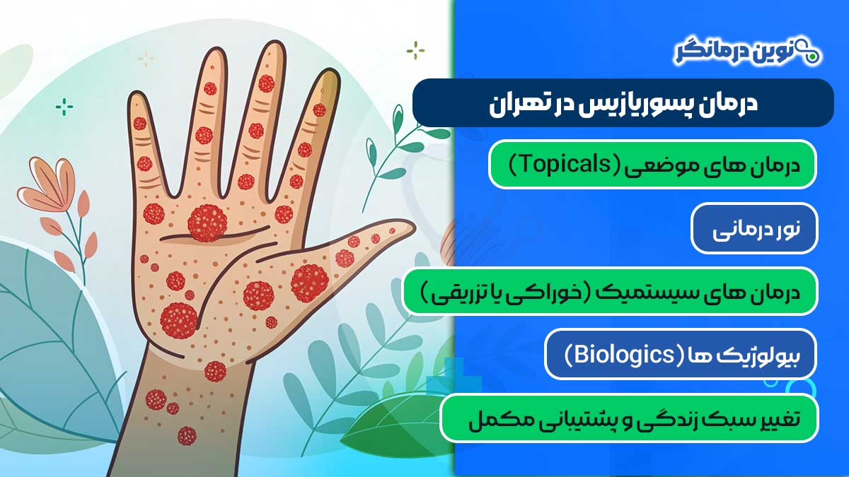 درمان پسوریازیس در تهران
