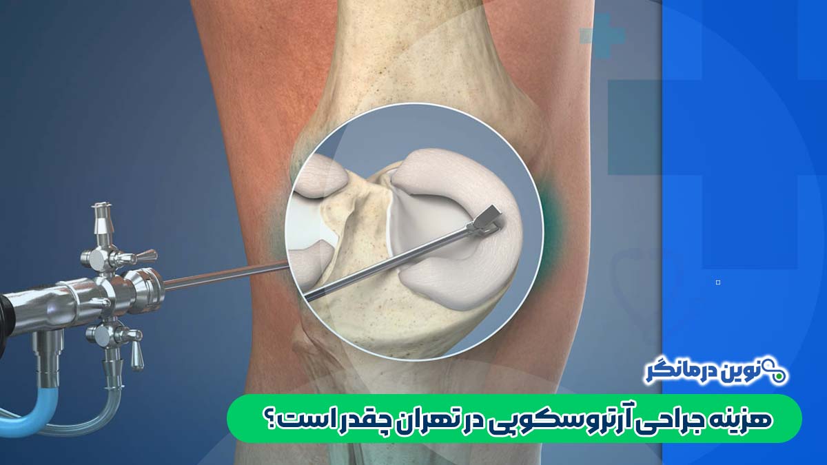 هزینه جراحی آرتروسکوپی در تهران چقدر است؟