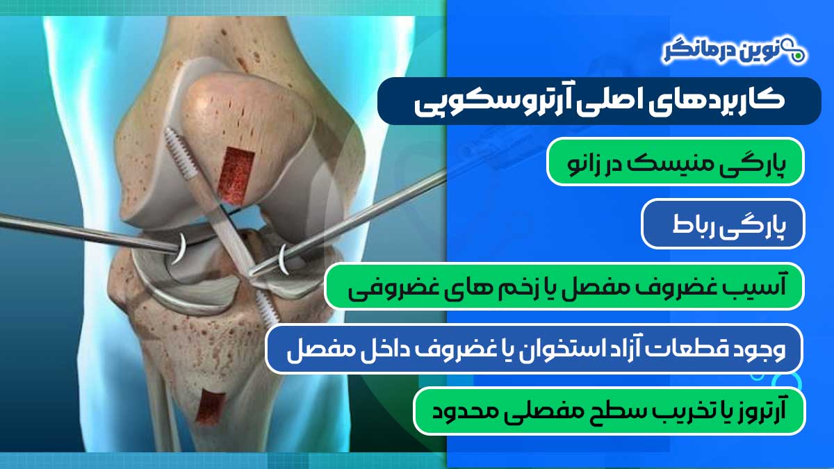 کاربردهای اصلی آرتروسکوپی
