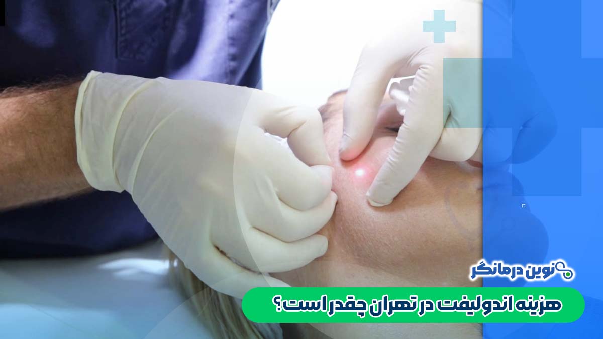 هزینه اندولیفت در تهران چقدر است؟