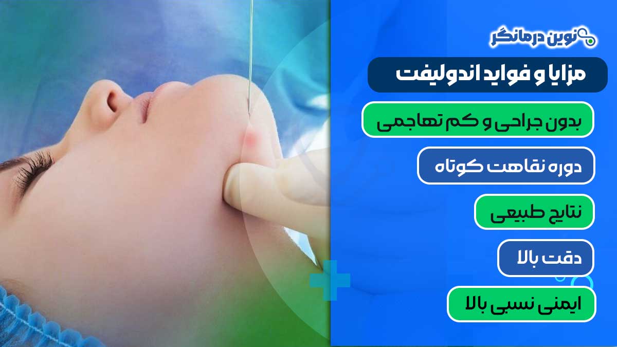 مزایا و فواید اندولیفت