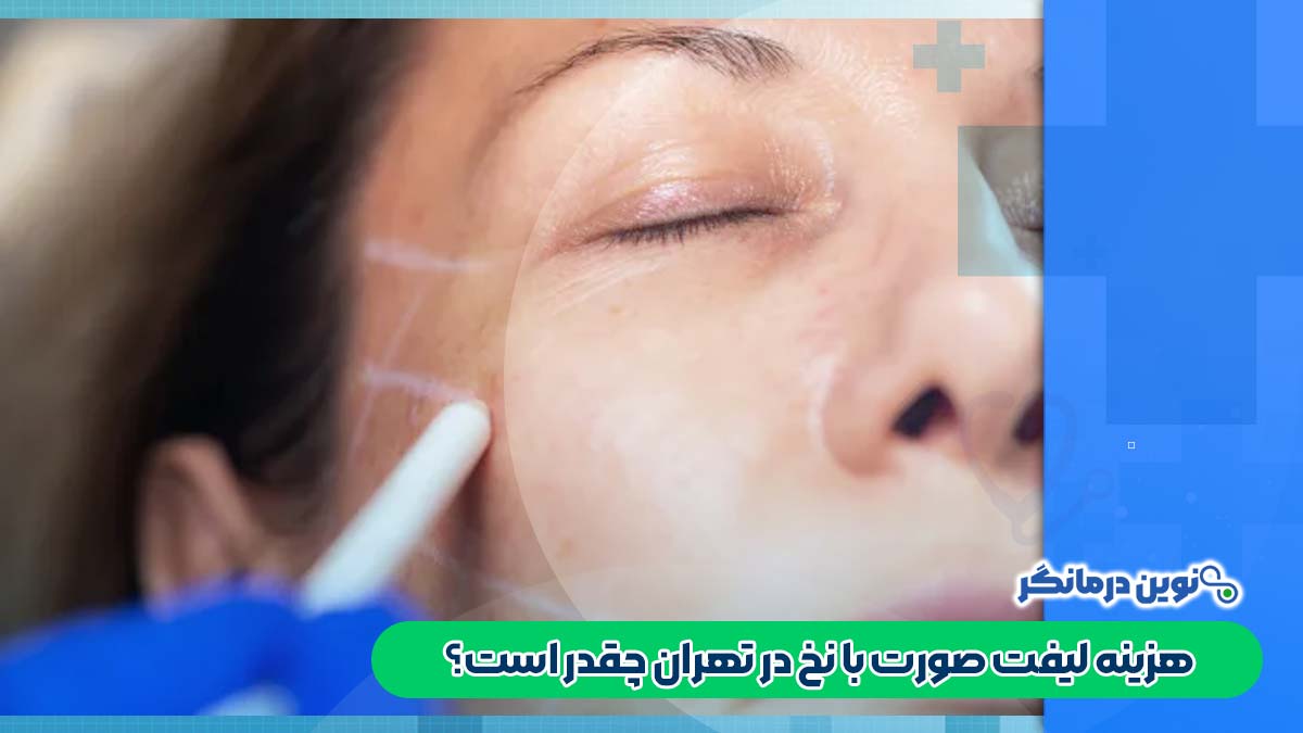 هزینه لیفت صورت با نخ در تهران چقدر است؟