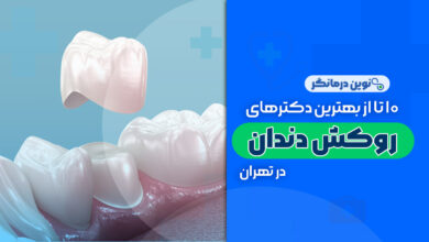 10 تا از بهترین دکترهای روکش دندان در تهران