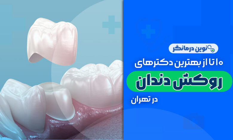 10 تا از بهترین دکترهای روکش دندان در تهران