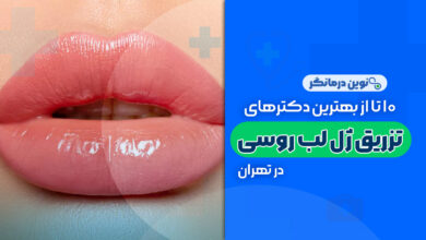 10 تا از بهترین دکترهای تزریق ژل لب روسی در تهران
