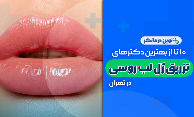 10 تا از بهترین دکترهای تزریق ژل لب روسی در تهران