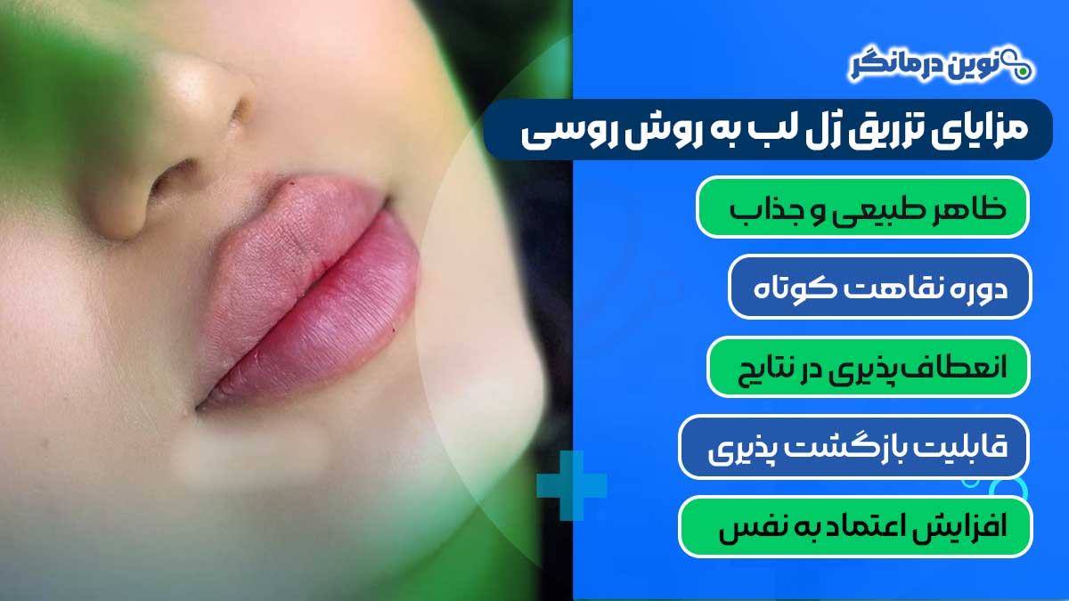 مزایای تزریق ژل لب به روش روسی
