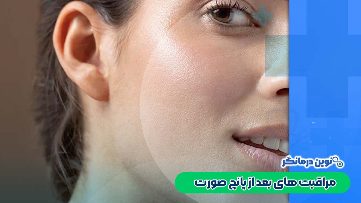 مراقبت های بعد از پانچ صورت