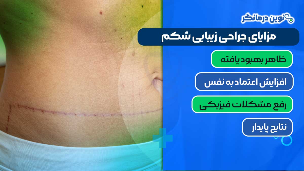 مزایای جراحی زیبایی شکم