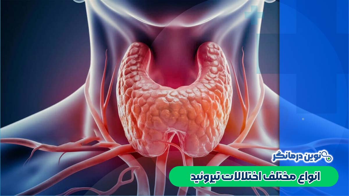 انواع مختلف اختلالات تیروئید