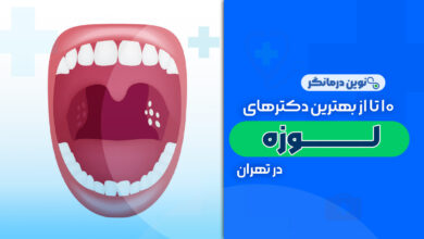 10 تا از بهترین دکترهای لوزه در تهران