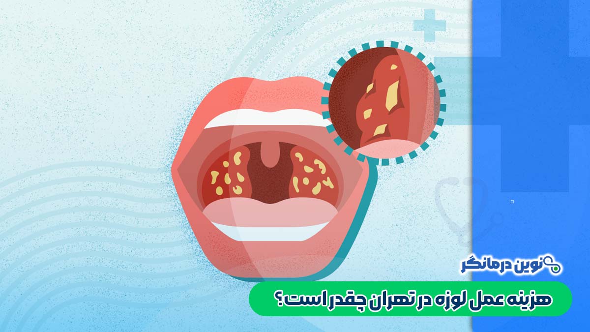 هزینه عمل لوزه در تهران چقدر است؟