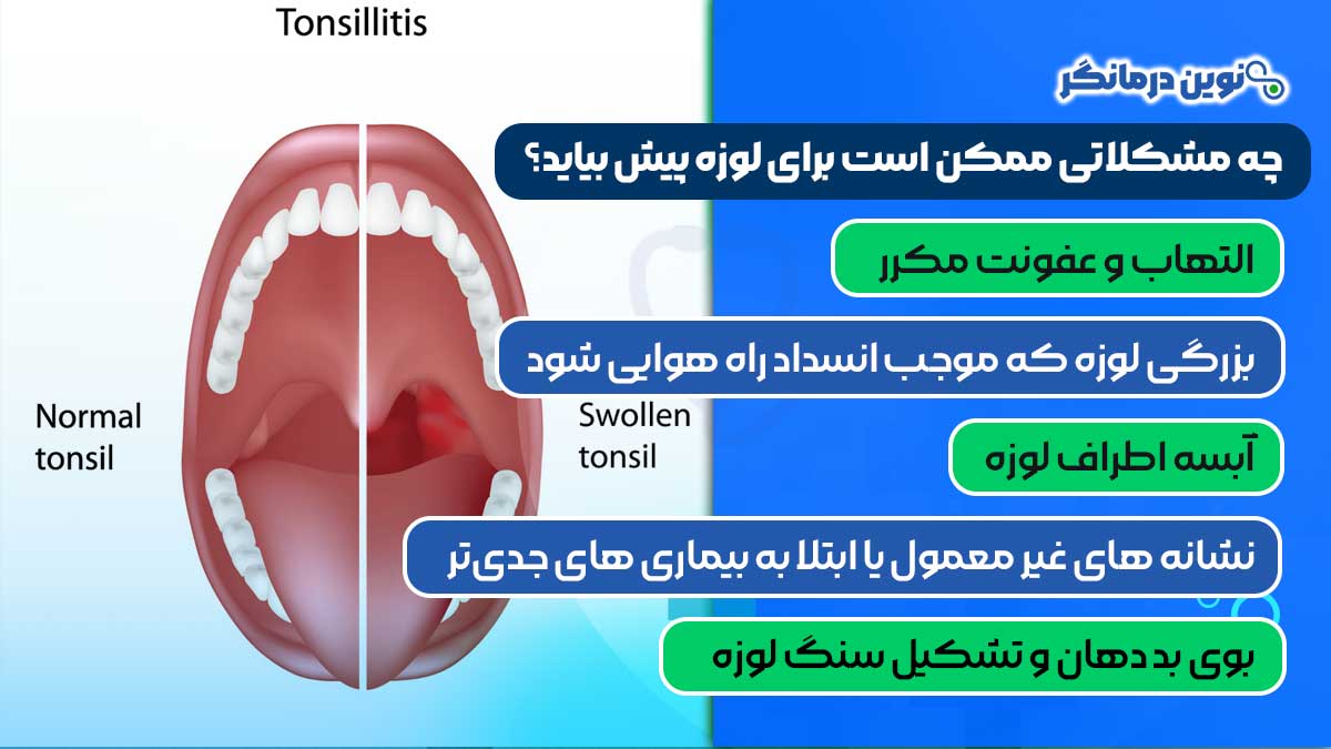 چه مشکلاتی ممکن است برای لوزه پیش بیاید؟