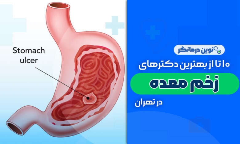 10 تا از بهترین دکترهای زخم معده در تهران