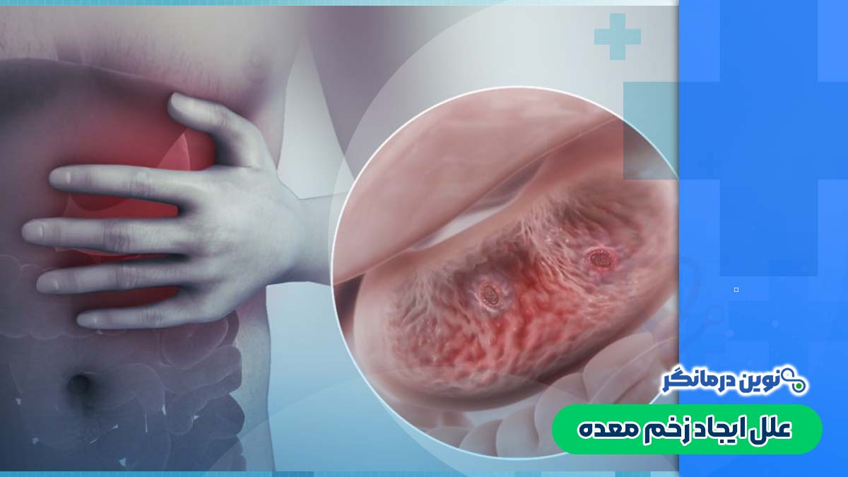 علل ایجاد زخم معده