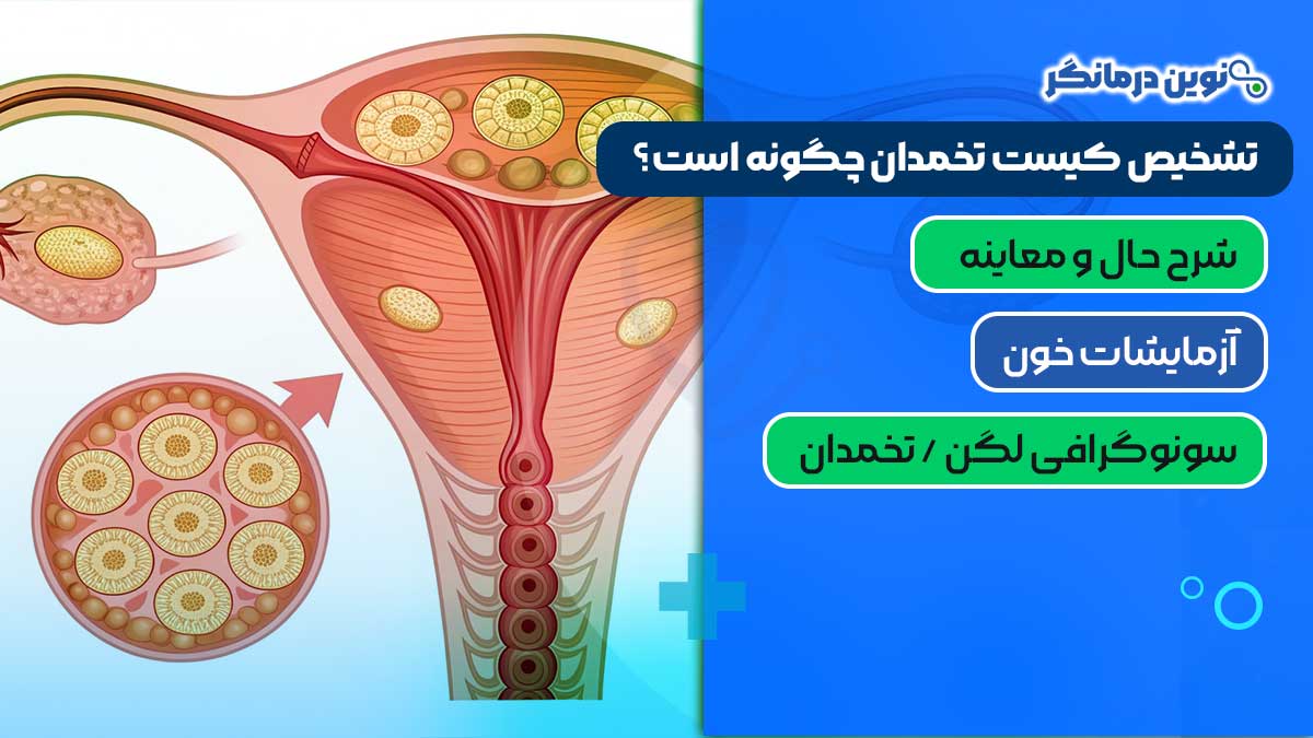 تشخیص کیست تخمدان چگونه است؟