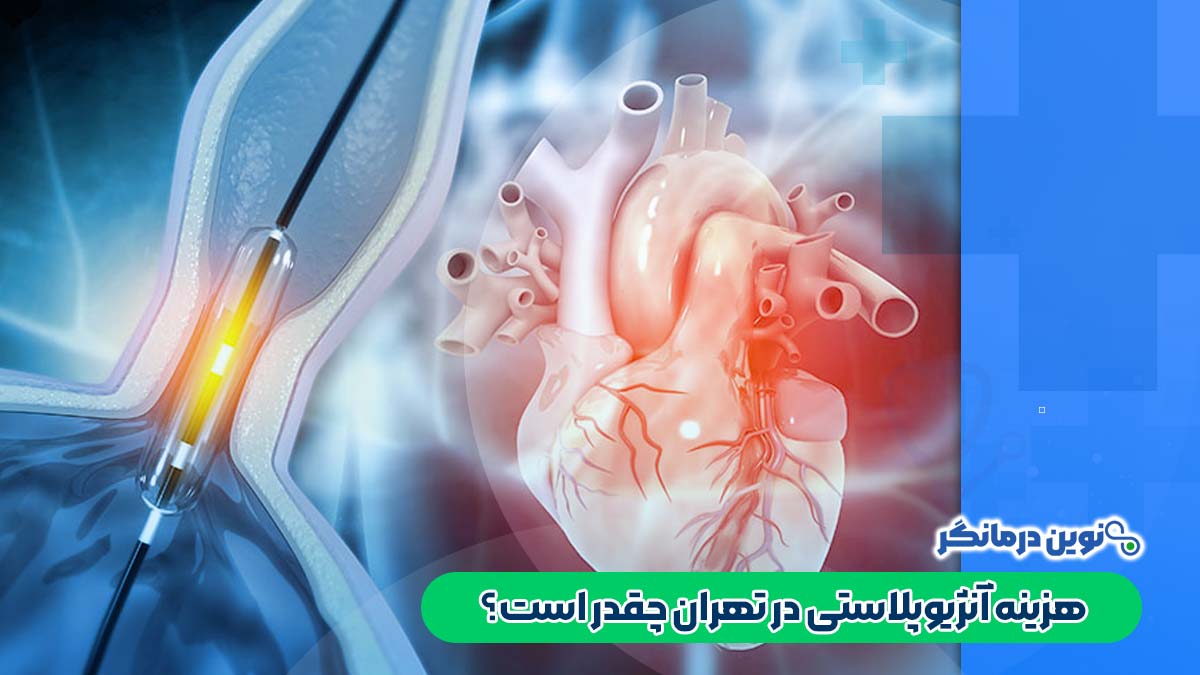 هزینه آنژیوپلاستی در تهران چقدر است؟