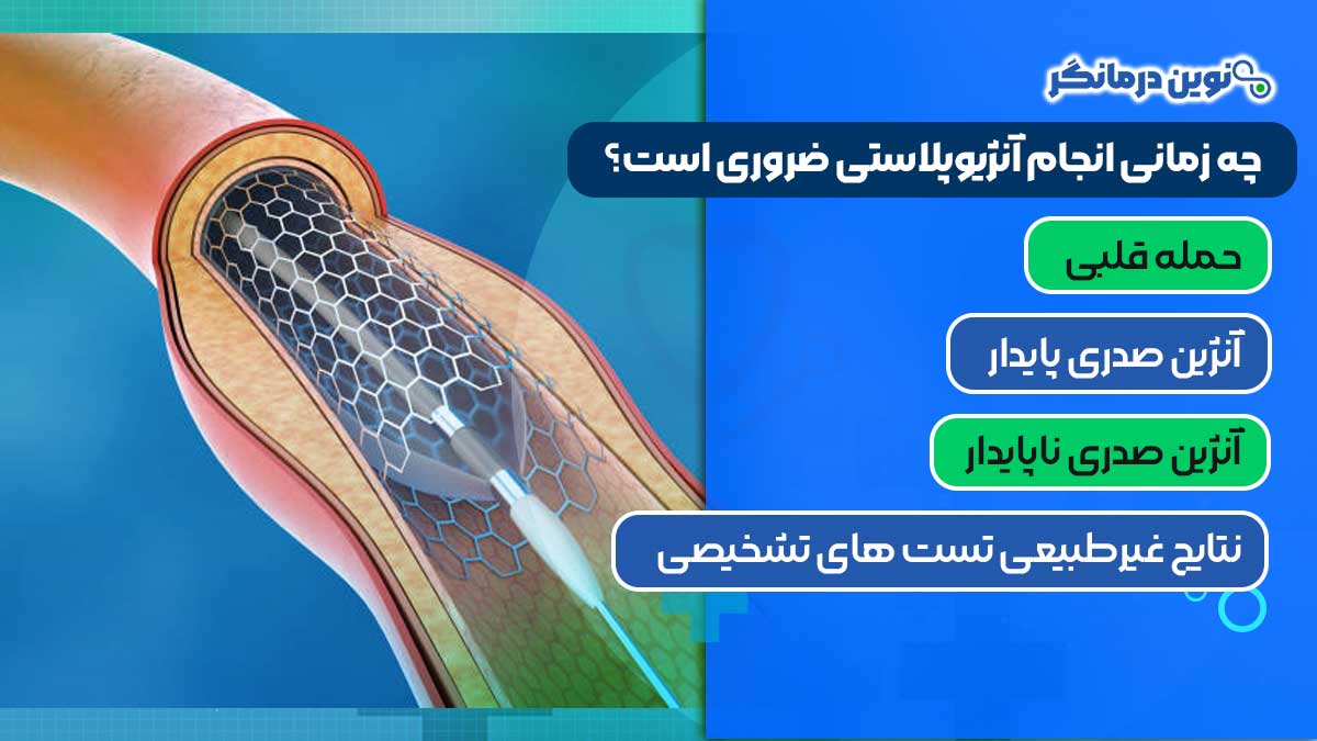چه زمانی انجام آنژیوپلاستی ضروری است؟