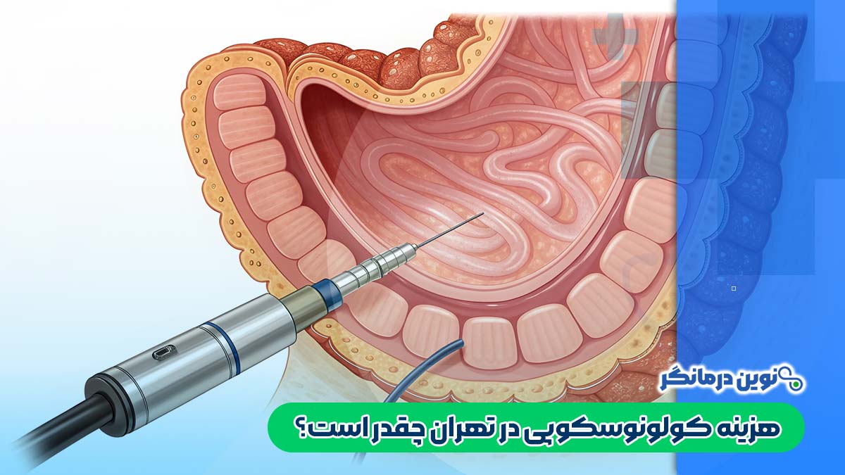 هزینه کولونوسکوپی در تهران چقدر است؟