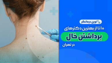 10 تا از بهترین دکترهای برداشتن خال در تهران