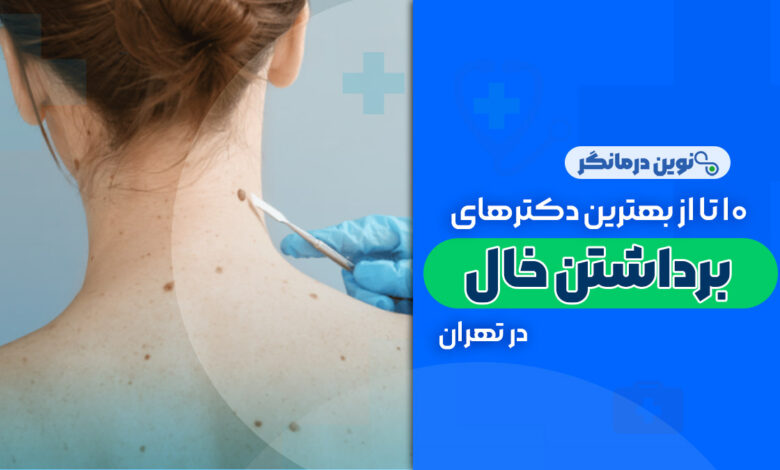 10 تا از بهترین دکترهای برداشتن خال در تهران