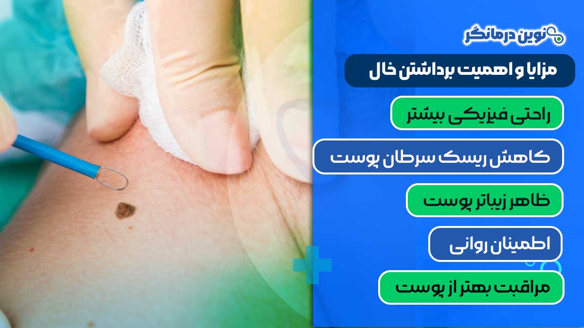 مزایا و اهمیت برداشتن خال