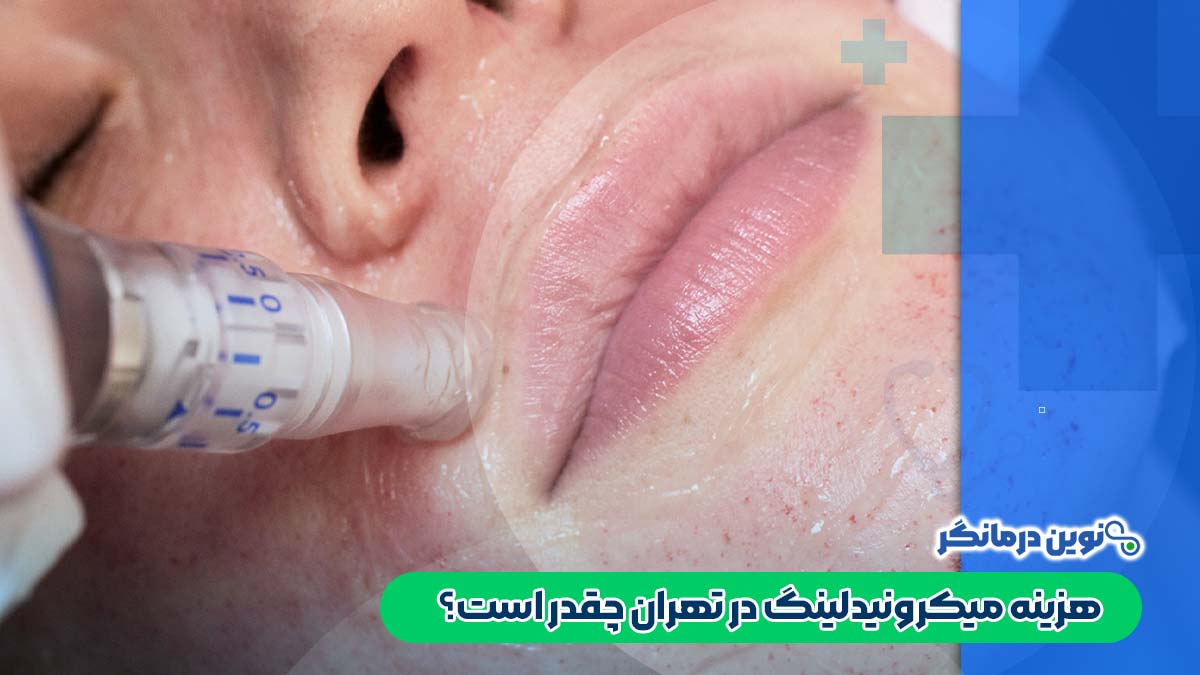 هزینه میکرونیدلینگ در تهران چقدر است؟