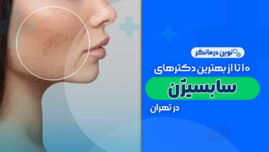 10 تا از بهترین دکترهای سابسیژن در تهران