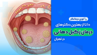 10 تا از بهترین دکترهای متخصص درمان زگیل دهانی در تهران