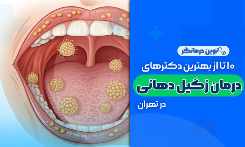 10 تا از بهترین دکترهای متخصص درمان زگیل دهانی در تهران