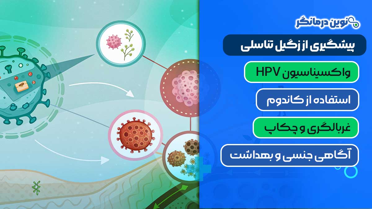 پیشگیری از زگیل تناسلی