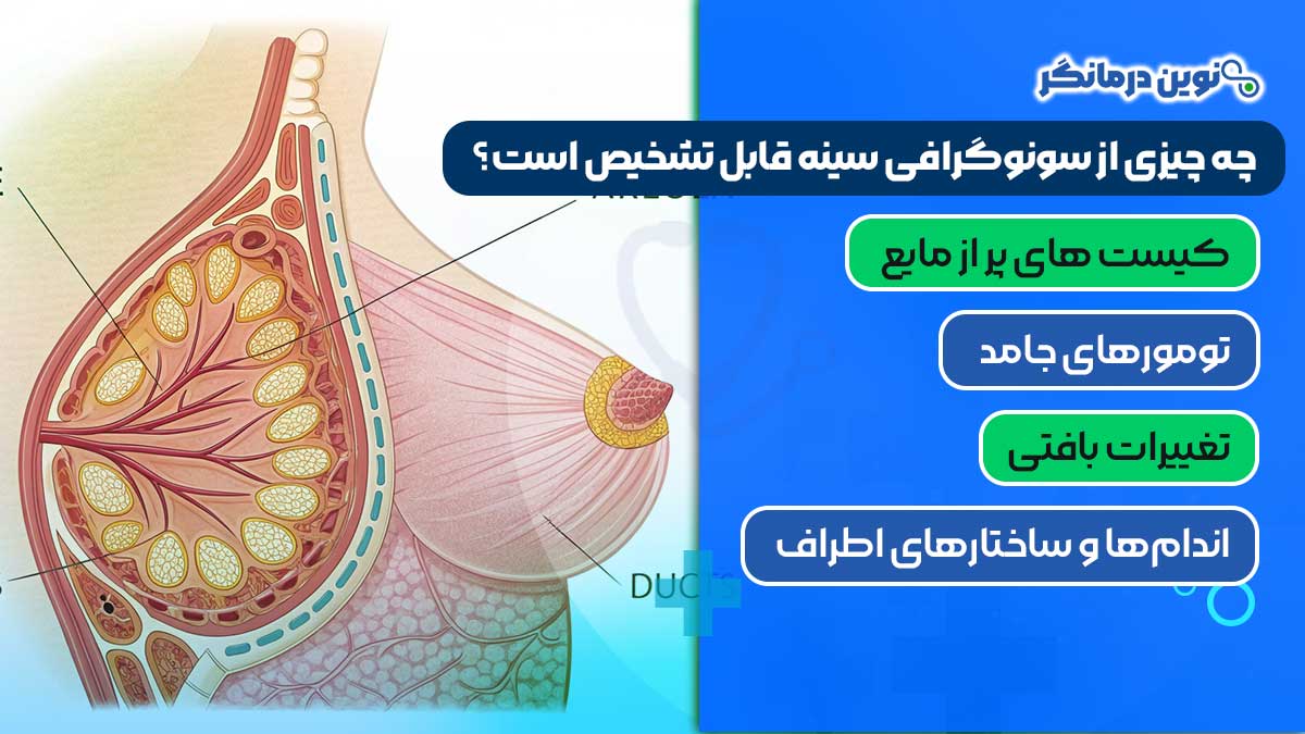 چه چیزی از سونوگرافی سینه قابل تشخیص است؟