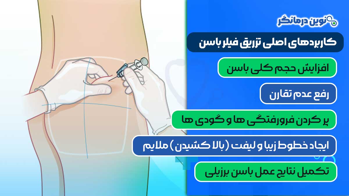 کاربردهای اصلی تزریق فیلر باسن