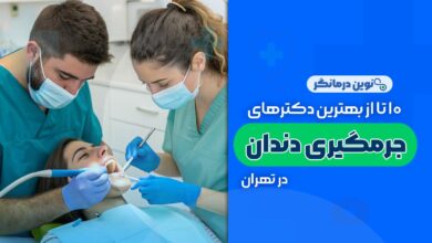 10 تا از بهترین دکترهای جرم گیری دندان در تهران