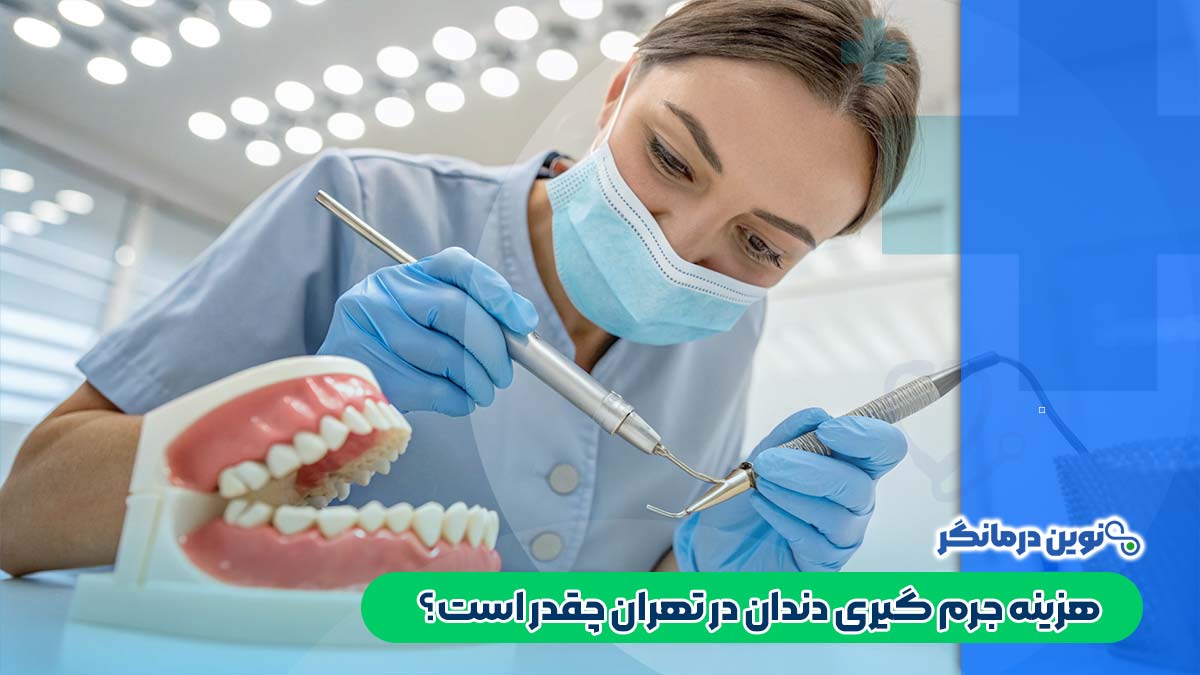 هزینه جرم گیری دندان در تهران چقدر است؟