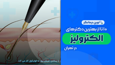 10 تا از بهترین مراکز الکترولیز در تهران