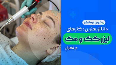 10 تا از بهترین دکترهای لیزر کک و مک در تهران