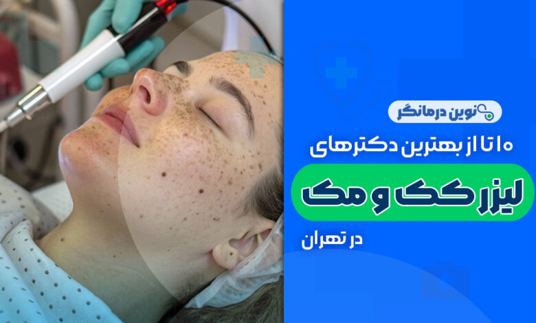 10 تا از بهترین دکترهای لیزر کک و مک در تهران