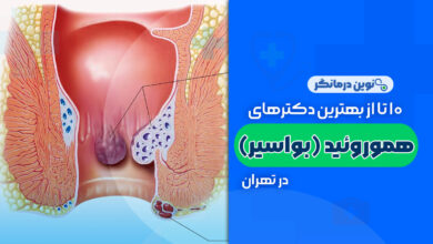 10 تا از بهترین دکترهای هموروئید (بواسیر) در تهران
