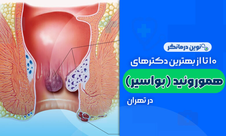 10 تا از بهترین دکترهای هموروئید (بواسیر) در تهران