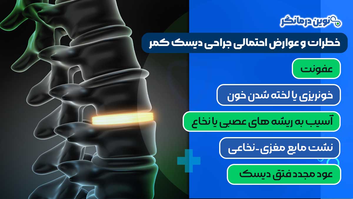 خطرات و عوارض احتمالی جراحی دیسک کمر