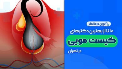 10 تا بهترین دکترهای جراحی کیست مویی در تهران