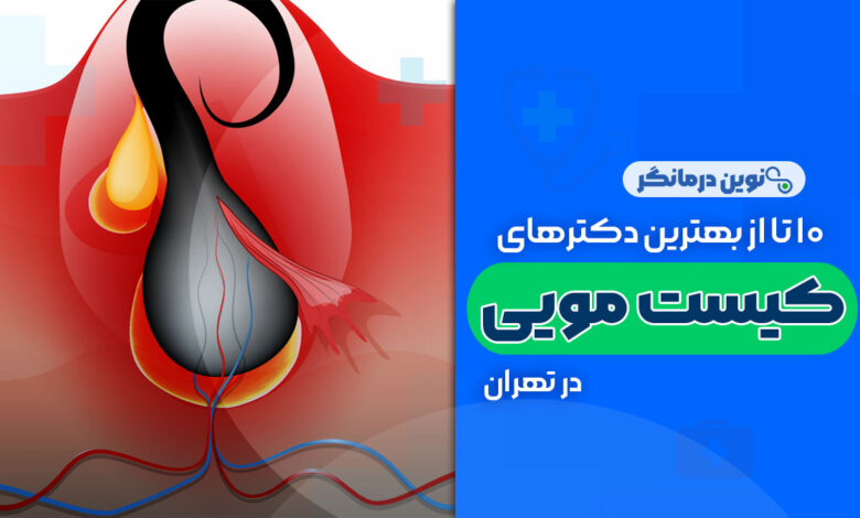 10 تا بهترین دکترهای جراحی کیست مویی در تهران