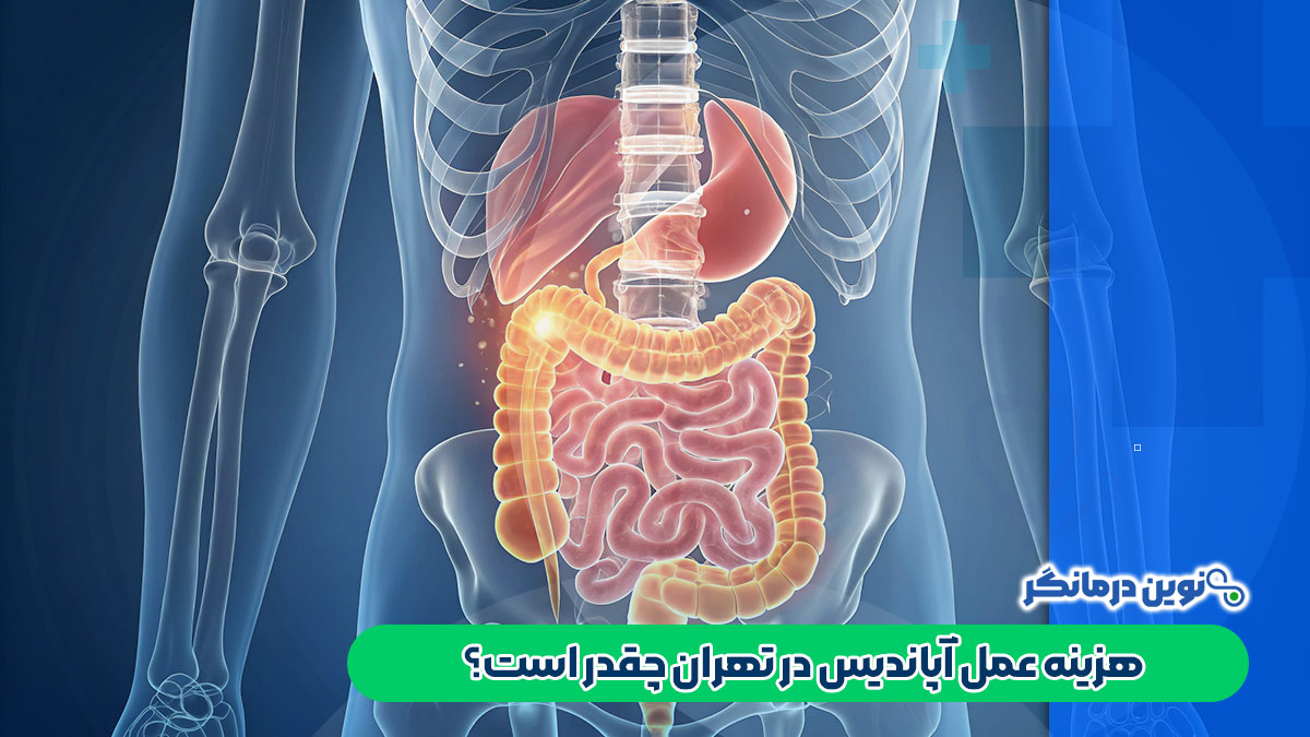 هزینه عمل آپاندیس در تهران چقدر است؟