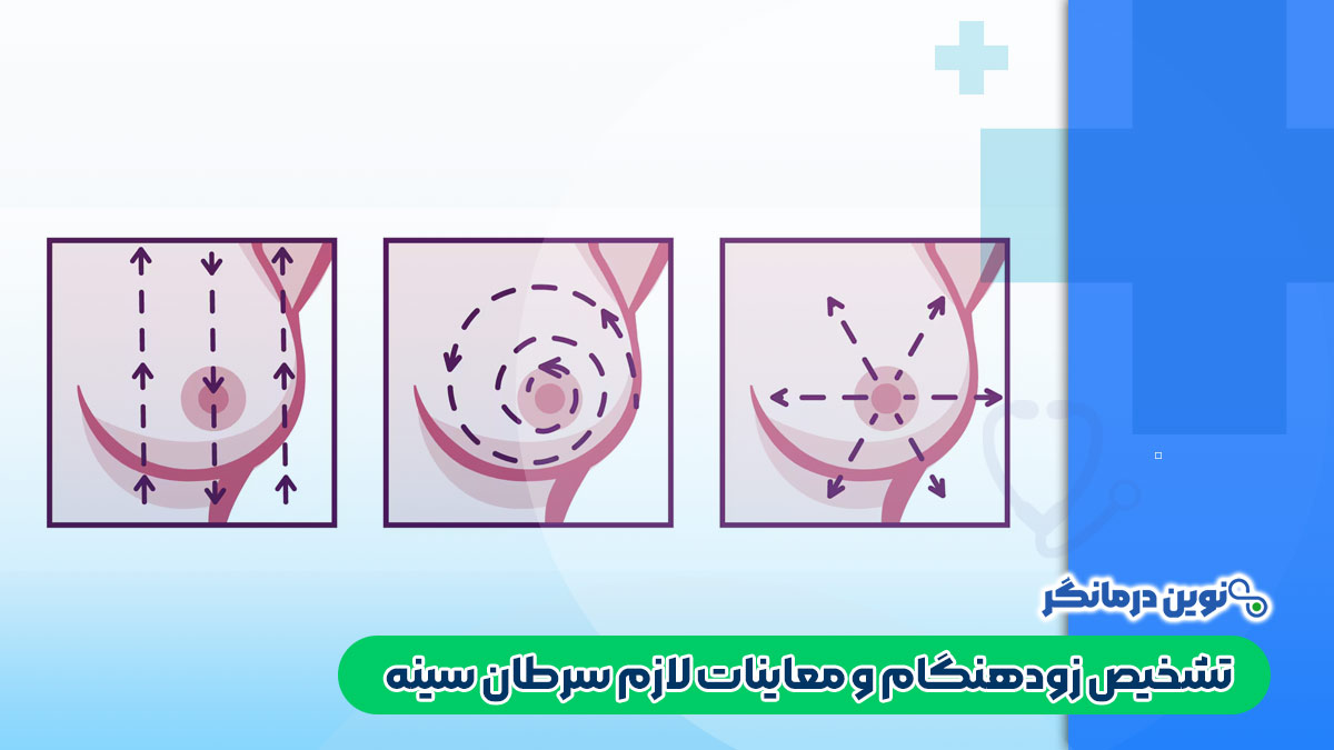 چگونه سرطان سینه شروع می‌شود؟