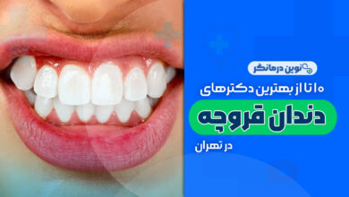 10 تا از بهترین دکترهای درمان دندان قروچه در تهران